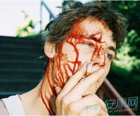 夢見自己頭上有血是什么意思 夢見自己頭上有血的含義