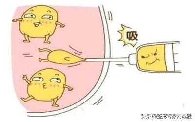 如何評價吸脂減肥？