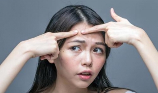 額頭很多痘痘怎么辦 怎么快速消除痘痘